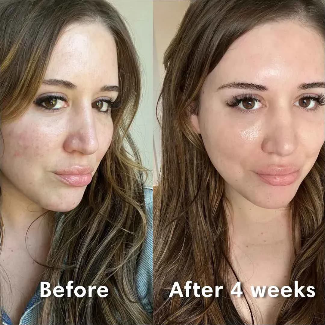 ماسک کلاژن بایودنس کره (یک عدد ماسک ورقه ای)