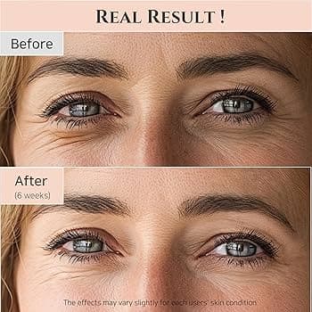 کرم دور چشم بیوتی آف جوسان حاوی جینسنگ و رتینال کره جنوبی