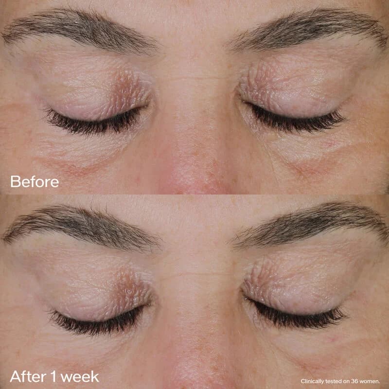 کرم دور چشم لیفت کننده و ضدچروک قوی شیسیدو اصل Vital Perfection